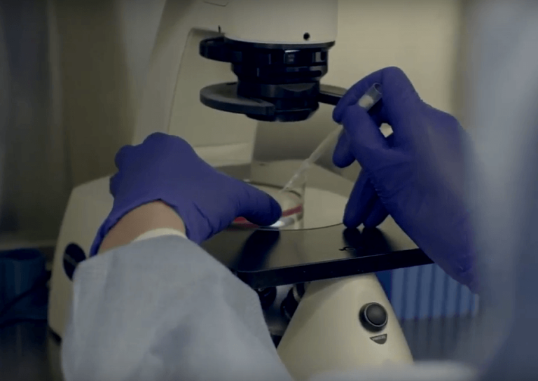 New ALS Gene Discovered: KIF5A – Answer ALS Shared Genomes Helped Lead to New Discovery